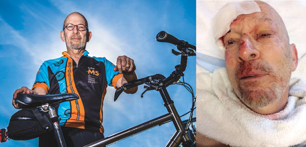 While prepping for a charity ride, bicyclist Rick Rovak (left) suffered serious injuries after an accident on Clayton Road, including (right) a deep laceration above his right eye, broken hips and a broken tailbone. Photo at left:  Scott Rovak