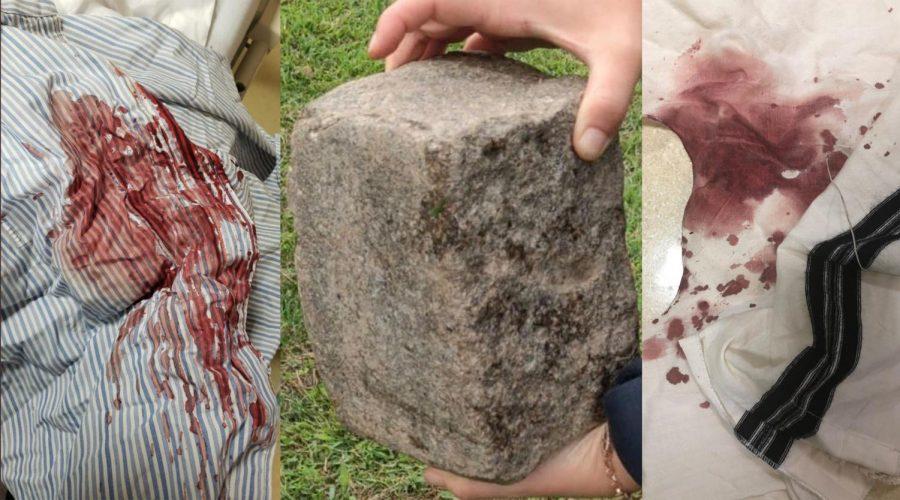 A+64-year-old+Hasidic+resident+of+Brooklyn+was+bloodied+with+this+brick+in+an+attack+being+investigated+by+police+as+a+hate+crime.+%28Screenshots+from+Twitter%29%C2%A0%C2%A0