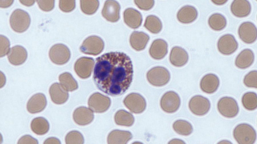 An eosinophil, a type of white blood cell.Photo by Dr. Graham Beards via Wikimedia Commons